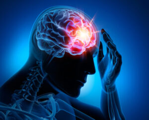 How Can Fellerman & Ciarimboli, Law PC Help My Family Recover Compensation After a Brain Injury in Kingston, PA?