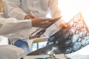 Why Choose Fellerman & Ciarimboli, Law PC for Help With a Brain Injury Claim in Lackawanna County, PA?